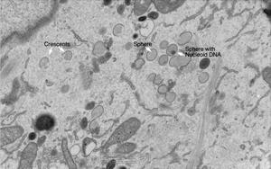 Nature Microbiology：一種以前未知的免疫反應途徑