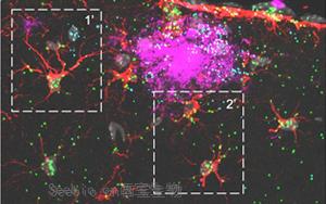 《Nature Neuroscience》可增強神經膠質細胞的蛋白質