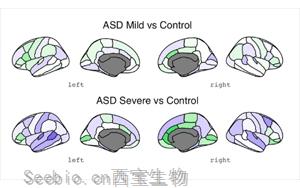 自閉癥最早的<font color='red'>生物學</font>跡象