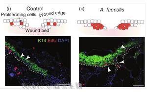 Science子刊揭示了一種細菌如何幫助慢性糖尿病傷口愈合