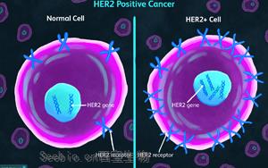 《自然醫學》：一種可以顯著延長乳腺癌患者生命的新藥