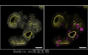 Cell：突破<font color='red'>類器官</font>研究限制！利用所有關鍵的胰腺細胞創造了一個新的<font color='red'>類器官</font>