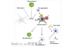 《Neuron》阿爾茨海默氏癥背后隱藏的罪魁禍首：顯微鏡下看小膠質(zhì)細胞